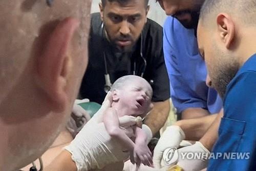 죽어가는 엄마 배 속에 있던 아기, 제왕절개로 생존. 사진=연합뉴스